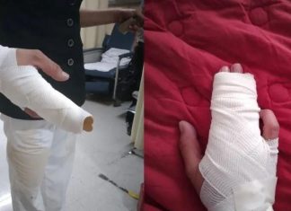 Enfermera del IMSS sufre agresión por parte de una familia y le fracturan dos dedos por miedo a coronavirus Enfermera del IMSS sufre agresión por parte de una familia y le fracturan dos dedos por miedo a coronavirus