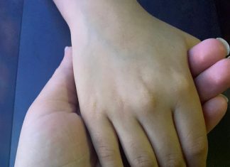 Línea de emergencia contra violencia de género ha logrado salvar vidas