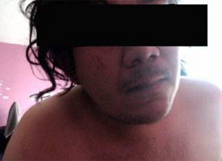 Policías Municipales asaltan y golpean a joven durante la madrugada