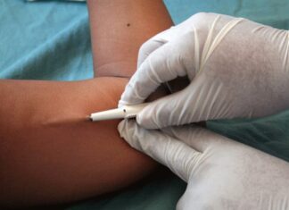 #Morelia Gratis implante subdérmico; conoce sus beneficios