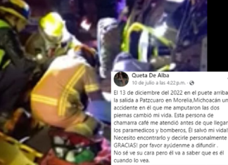 Morelia: le amputaron las piernas y quiere agradecer a quién le ayudó a sobrevivir