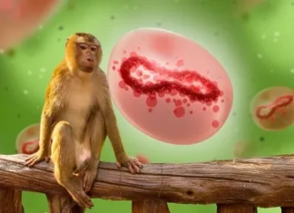 OMS Declara Emergencia Mundial por Virus Mpox: Conoce los Síntomas y Medidas de Precaución