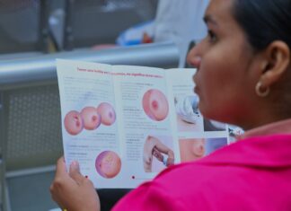 Arranca SSM actividades del Mes de Sensibilización sobre el Cáncer de Mama