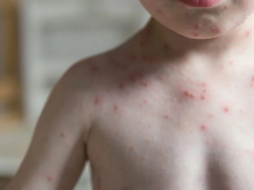 WhatsApp Image 2025-05-19 at 9.07.44 AM