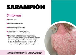 Identifica los síntomas del sarampión y protege tu salud: SSM